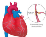 HEARTY