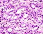 panceratic cells