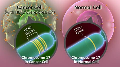 New signaling pathway discovered in HER2-positive breast cancer, and 2 powerful drug targets