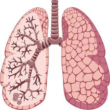 Risk posed by lung nodules identified by new software