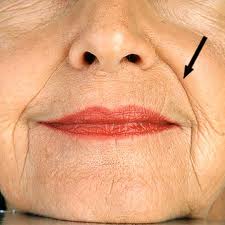 Controlling the formation of wrinkles, creases, folds