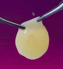 Novel tissue engineered bone graft achieves successful repair of bone defects