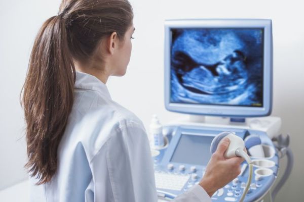 ultrasound suppliers