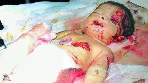 dead-baby-guntur-hospital