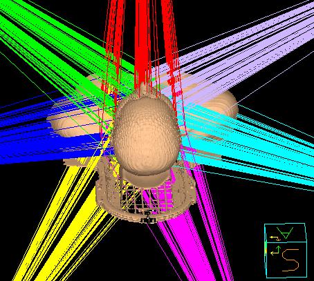 Medical Healthcare using Wireless Body Area Network