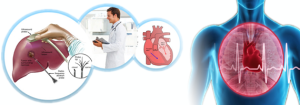 radiofrequency-catheter-ablation