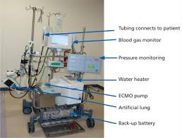 Jayalalithaas illness highlights ECMO