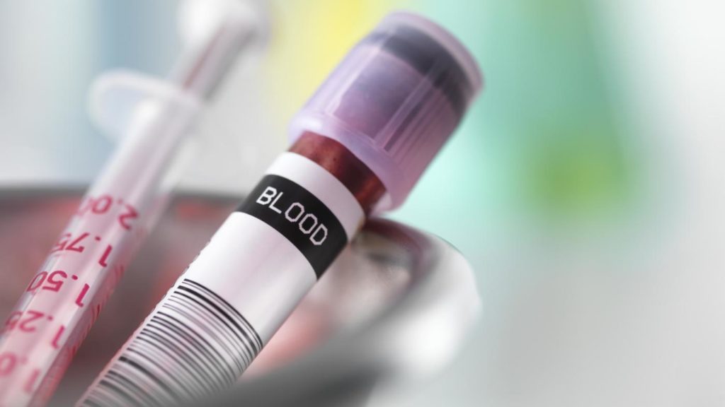 CBC: A diagnostic test to understand your relation with your blood!