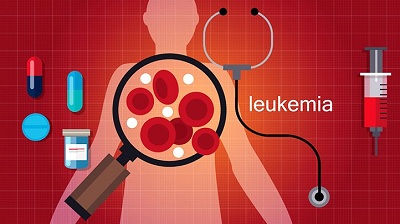 ‘Leukemia patients with high levels of immune suppressor likely to die early’