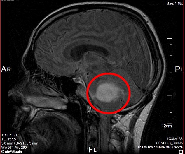 MRI scans to predict patients’ ability to fight cancer