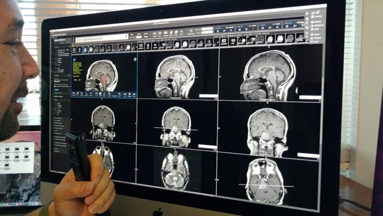 Pioneering Therapies with Interventional Radiology