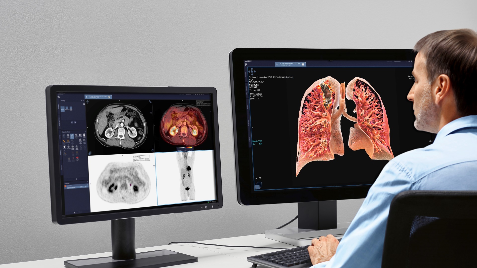 Radiia launches radiology second opinion service