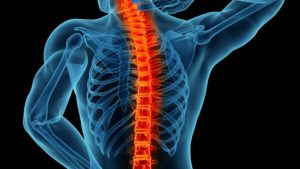 spinal surgery