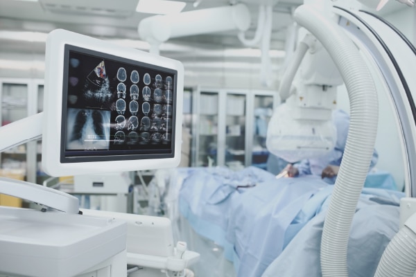 Rise and Impact of Advanced Imaging Technology