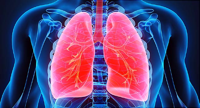 Pulmonary fibrosis