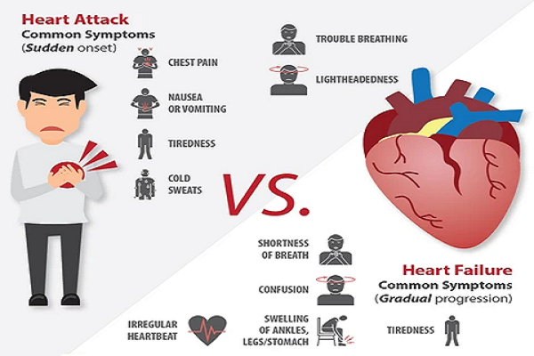 Heart Attack and Heart Failure: Knowing the difference