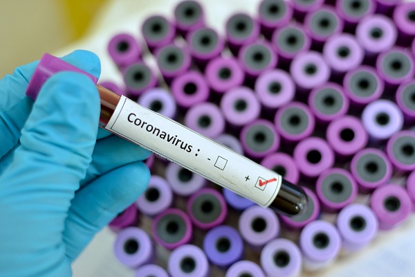 CORONAVIRUS:  What precautions one should take to avoid infection, explains expert