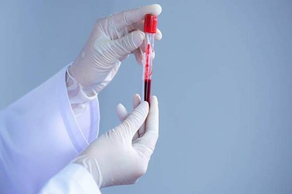 Covid-19: Vishat Diagnostics gets ICMR nod to supply antigen testing kit