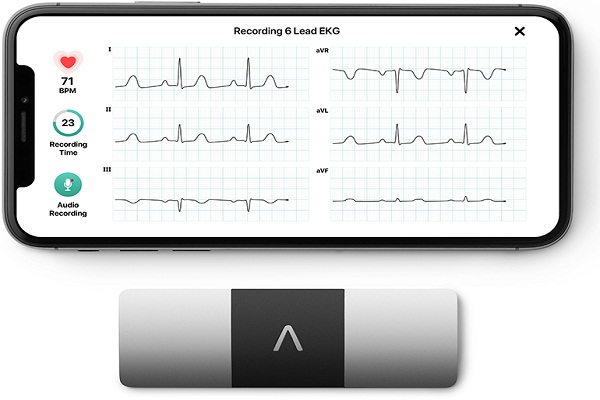  KardiaMobile 1-Lead Personal EKG Monitor – Record EKGs at Home  – Detects AFib and Irregular Arrhythmias – Instant Results in 30 Seconds –  Easy to Use – Works with Most