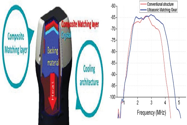 Power View and Crystal Signature Tech in Ultrasound