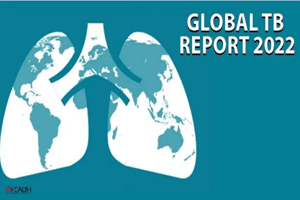 Global TB report 2022