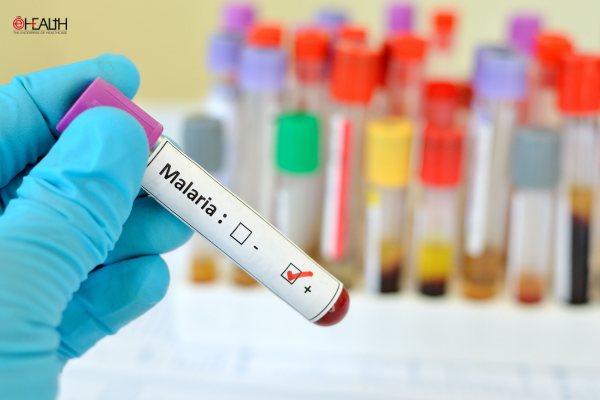 Multistage Malaria Vaccine Trial Signals New Opportunity for Next-Gen Immunisation Research